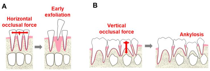https://cdn.ncbi.nlm.nih.gov/pmc/blobs/bd79/7823531/10e2d1607fbd/dentistry-09-00003-g003.jpg