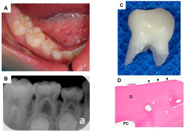 https://cdn.ncbi.nlm.nih.gov/pmc/blobs/bd79/7823531/3c2261ba4d41/dentistry-09-00003-g002.jpg