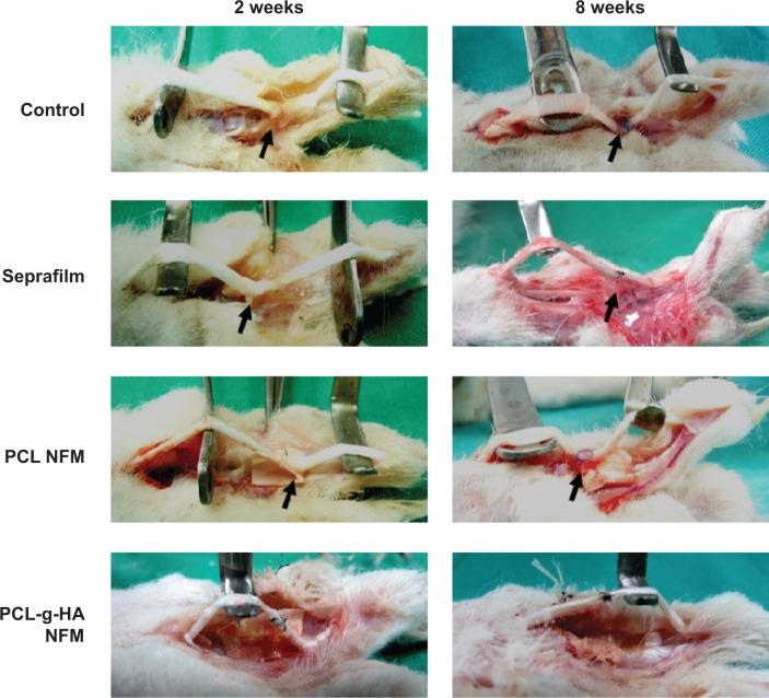 https://cdn.ncbi.nlm.nih.gov/pmc/blobs/bd7c/4149458/9d5e150dd27e/ijn-9-4079Fig6.jpg