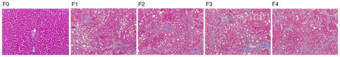 https://cdn.ncbi.nlm.nih.gov/pmc/blobs/bd7d/7851601/4670b1d64e6f/etm-21-03-09656-g02.jpg