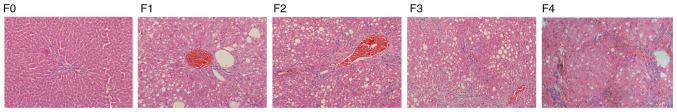https://cdn.ncbi.nlm.nih.gov/pmc/blobs/bd7d/7851601/a8f0e04c382c/etm-21-03-09656-g01.jpg