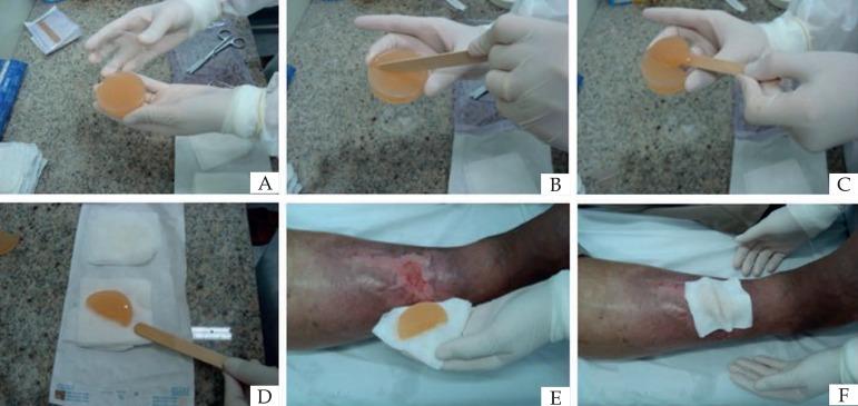 https://cdn.ncbi.nlm.nih.gov/pmc/blobs/bd80/5595596/104400b09724/abd-92-04-0499-g01.jpg