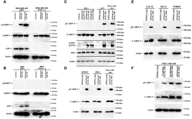 https://cdn.ncbi.nlm.nih.gov/pmc/blobs/bd83/11096501/291dccce589e/fonc-14-1376666-g004.jpg
