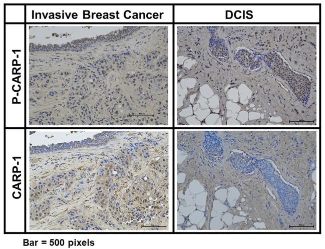https://cdn.ncbi.nlm.nih.gov/pmc/blobs/bd83/11096501/ffba3c73e790/fonc-14-1376666-g006.jpg