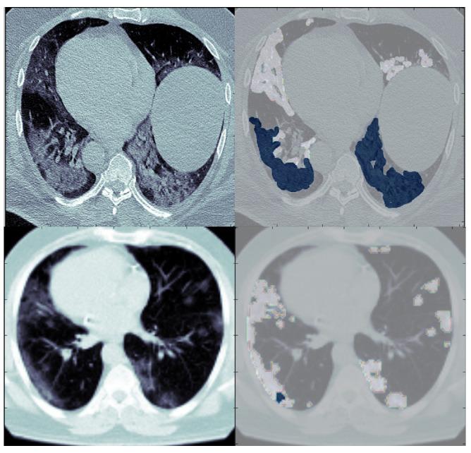 https://cdn.ncbi.nlm.nih.gov/pmc/blobs/bd89/10178408/f558df2e433a/diagnostics-13-01658-g001.jpg