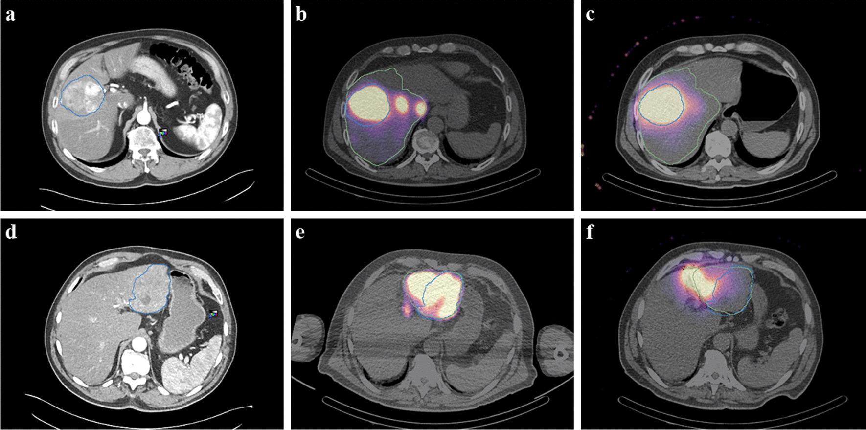 https://cdn.ncbi.nlm.nih.gov/pmc/blobs/bd8a/10317941/9cfd86e36881/13550_2023_1011_Fig2_HTML.jpg