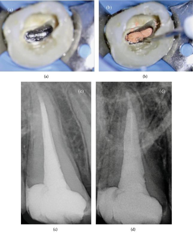 https://cdn.ncbi.nlm.nih.gov/pmc/blobs/bd99/6854219/c6f2dc5a1b20/CRID2019-1857289.003.jpg