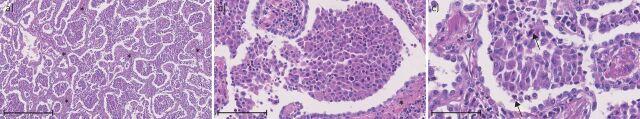 https://cdn.ncbi.nlm.nih.gov/pmc/blobs/bdac/9488565/be70c6c0a221/ERR-0181-2019.02.jpg