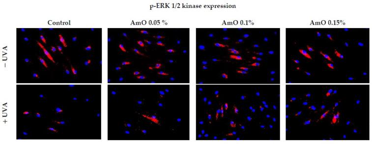 https://cdn.ncbi.nlm.nih.gov/pmc/blobs/bdb6/10815470/92b66bacbc9a/ijms-25-00925-g004.jpg
