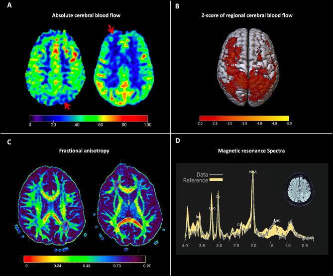 https://cdn.ncbi.nlm.nih.gov/pmc/blobs/bdb8/11225195/afd9adc0b7cd/12883_2024_3745_Fig1_HTML.jpg