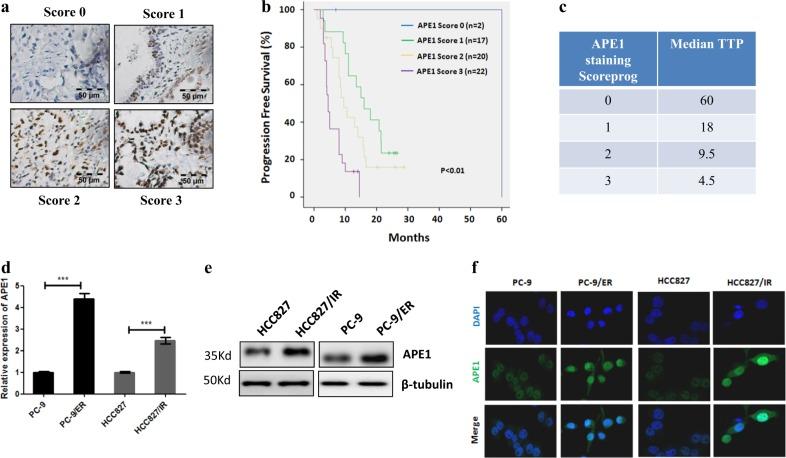 https://cdn.ncbi.nlm.nih.gov/pmc/blobs/bdbb/6208429/27395d64929a/41419_2018_1162_Fig1_HTML.jpg