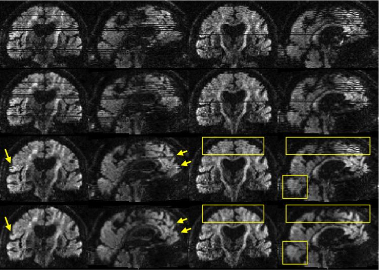 https://cdn.ncbi.nlm.nih.gov/pmc/blobs/bdbd/5445723/74004051bfa5/gr17.jpg