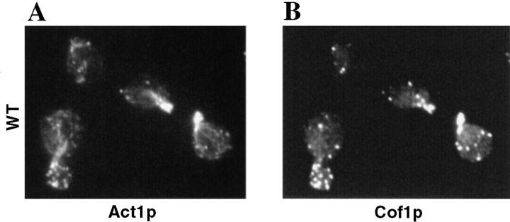 https://cdn.ncbi.nlm.nih.gov/pmc/blobs/bdca/2133144/4fbc91ea0387/JCB9811047.f6ab.jpg