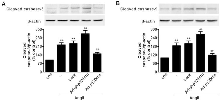 https://cdn.ncbi.nlm.nih.gov/pmc/blobs/bdcc/4771121/4e9108f5dcf4/IJMM-37-03-0623-g04.jpg