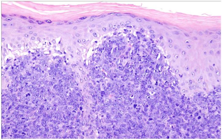 https://cdn.ncbi.nlm.nih.gov/pmc/blobs/bdcf/10137297/4a3efd1041af/cancers-15-02285-g012.jpg