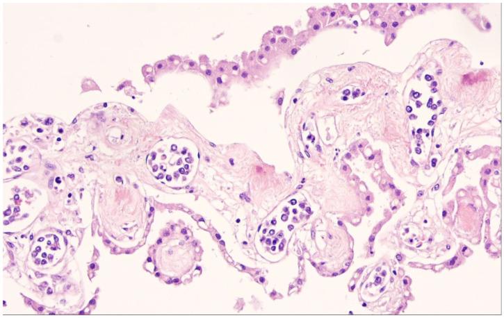 https://cdn.ncbi.nlm.nih.gov/pmc/blobs/bdcf/10137297/937bb9a738e9/cancers-15-02285-g013.jpg