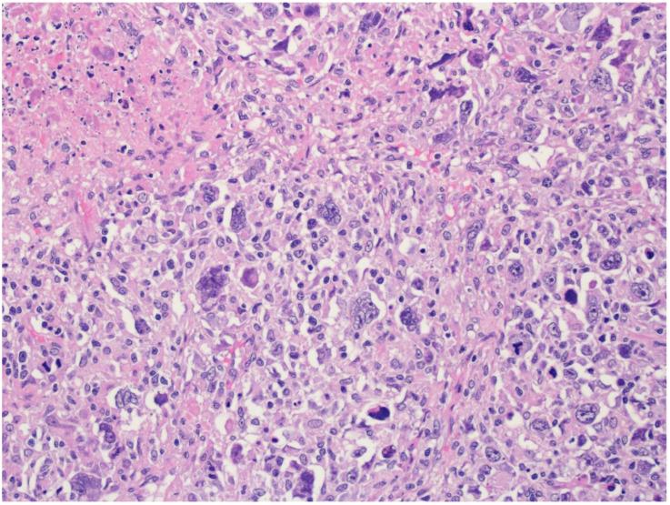 https://cdn.ncbi.nlm.nih.gov/pmc/blobs/bdcf/10137297/cf61fc3cb422/cancers-15-02285-g007.jpg