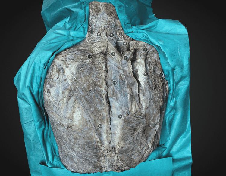 https://cdn.ncbi.nlm.nih.gov/pmc/blobs/bdd3/9364063/290d6dbf57a4/cureus-0014-00000026727-i01.jpg