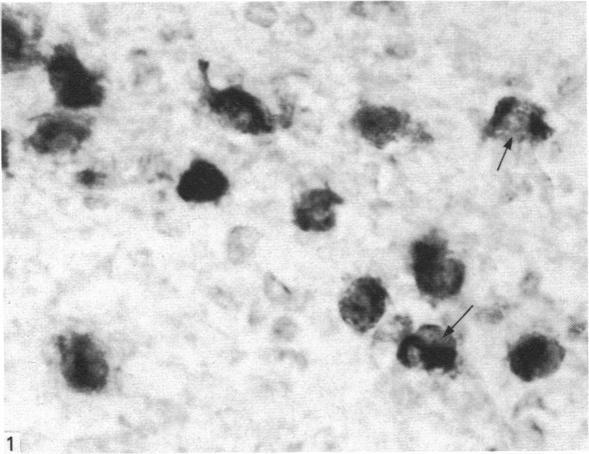 https://cdn.ncbi.nlm.nih.gov/pmc/blobs/bddc/1164441/7bfe99ebc55d/janat00197-0010-a.jpg