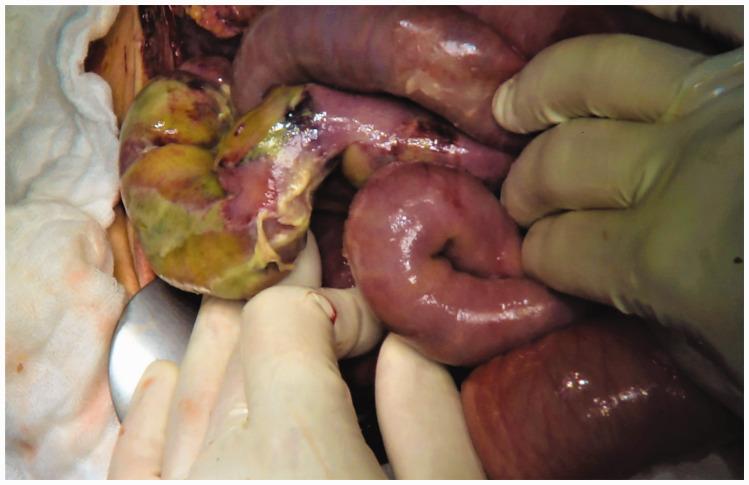 https://cdn.ncbi.nlm.nih.gov/pmc/blobs/bdde/7436833/0f239c028b10/10.1177_0300060520929128-fig4.jpg
