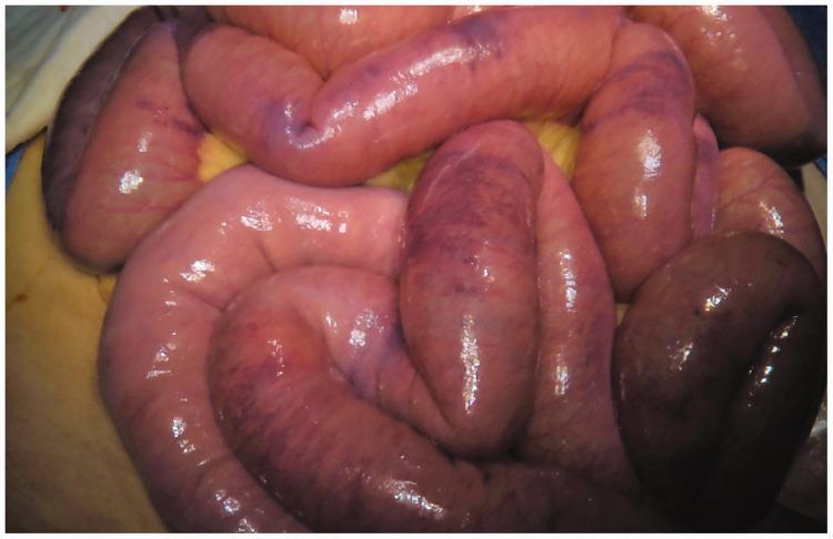 https://cdn.ncbi.nlm.nih.gov/pmc/blobs/bdde/7436833/93f26021e4dd/10.1177_0300060520929128-fig3.jpg