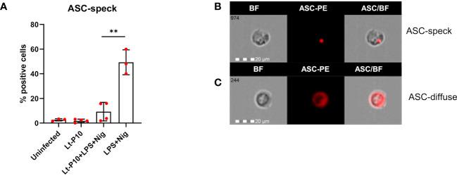 https://cdn.ncbi.nlm.nih.gov/pmc/blobs/bde3/11066211/69c16701054d/fimmu-15-1298275-g003.jpg