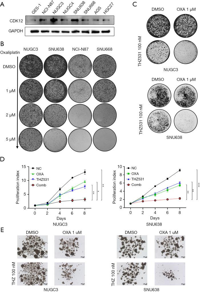 https://cdn.ncbi.nlm.nih.gov/pmc/blobs/bde4/12261016/8663a613b2e6/jgo-16-03-823-f3.jpg