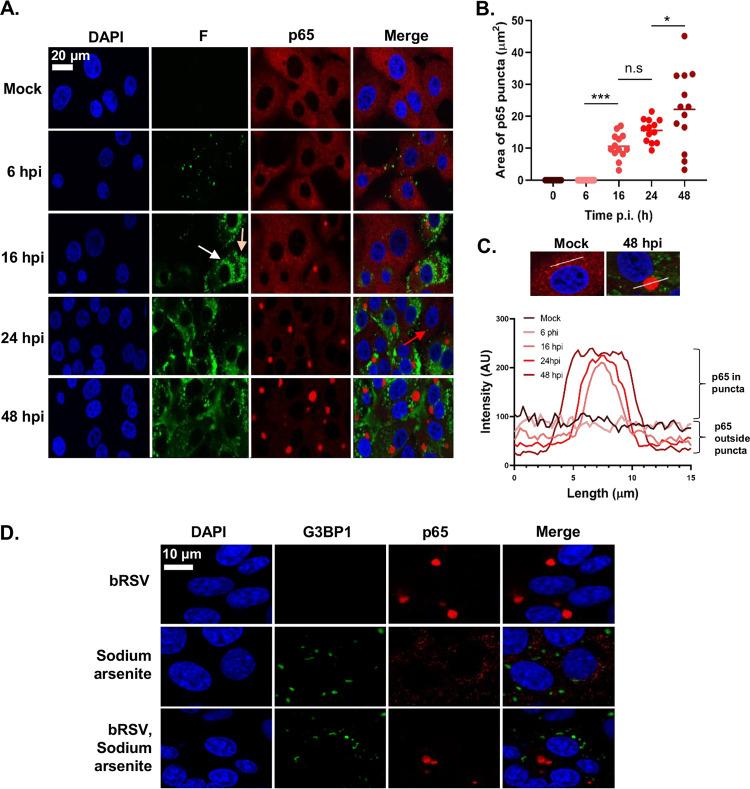 https://cdn.ncbi.nlm.nih.gov/pmc/blobs/bdef/7592213/f494358e13a6/JVI.01380-20-f0002.jpg