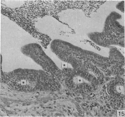 https://cdn.ncbi.nlm.nih.gov/pmc/blobs/bdfd/1233029/02bf6bd191a6/janat00239-0188-b.jpg