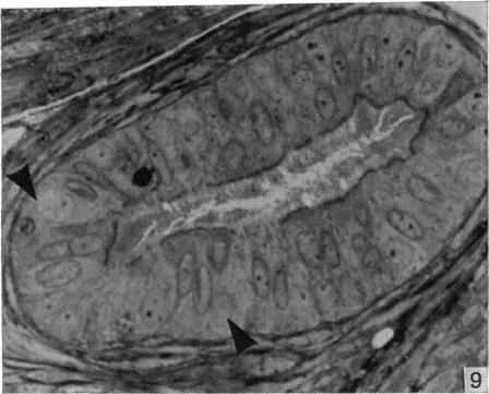 https://cdn.ncbi.nlm.nih.gov/pmc/blobs/bdfd/1233029/1813cff90156/janat00239-0185-b.jpg