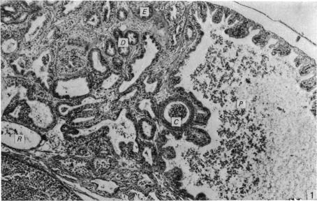 https://cdn.ncbi.nlm.nih.gov/pmc/blobs/bdfd/1233029/1ffdeb4ce9f0/janat00239-0181-a.jpg