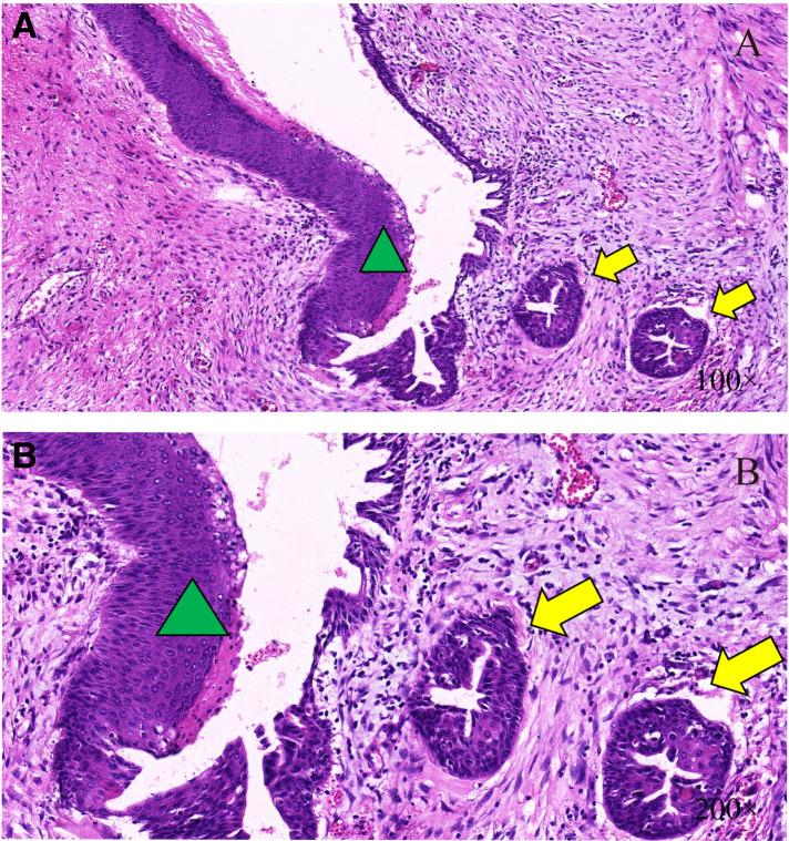 https://cdn.ncbi.nlm.nih.gov/pmc/blobs/be10/9871623/2703991946b7/fsurg-09-983611-g004.jpg