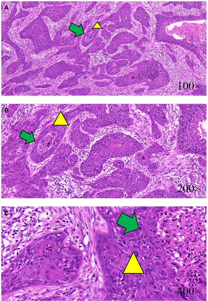 https://cdn.ncbi.nlm.nih.gov/pmc/blobs/be10/9871623/359ddd14a54e/fsurg-09-983611-g003.jpg