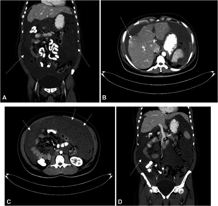 https://cdn.ncbi.nlm.nih.gov/pmc/blobs/be14/11465061/58606721326f/gr1.jpg