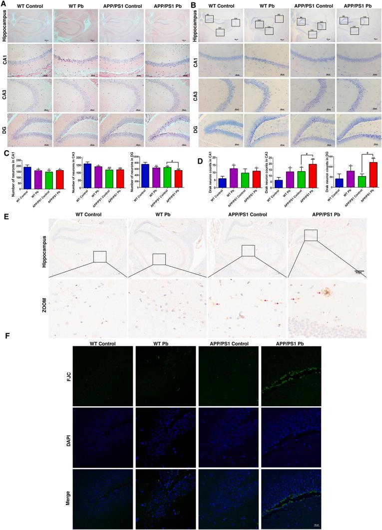 https://cdn.ncbi.nlm.nih.gov/pmc/blobs/be15/10716782/a8ef18c048c6/gr2.jpg
