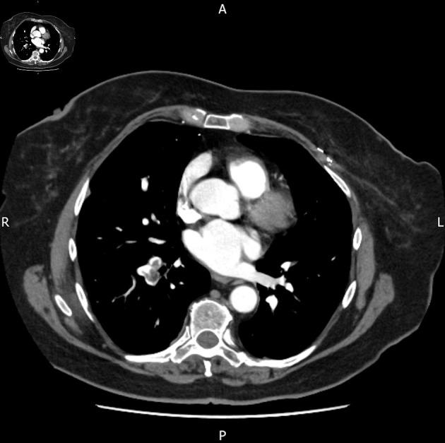 https://cdn.ncbi.nlm.nih.gov/pmc/blobs/be18/11287908/0fe245037a98/jmc-15-180-g006.jpg