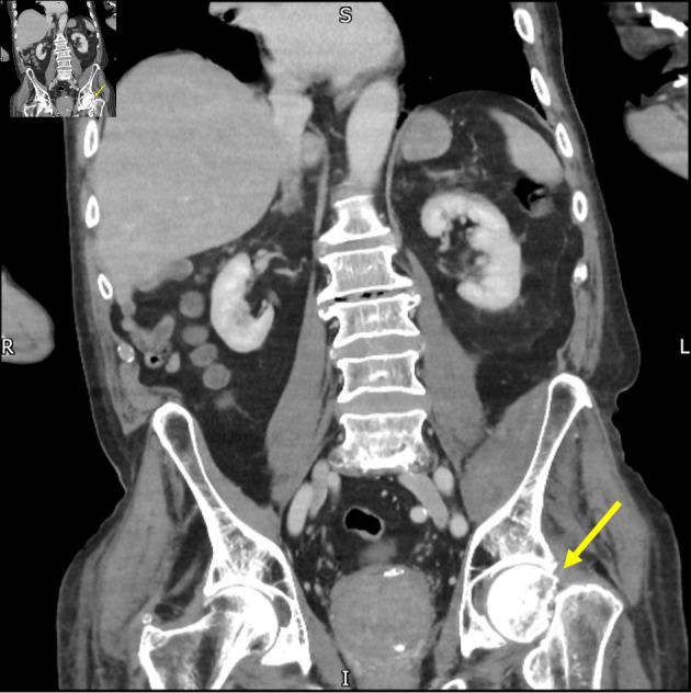 https://cdn.ncbi.nlm.nih.gov/pmc/blobs/be18/11287908/b4d3d4a19b61/jmc-15-180-g002.jpg