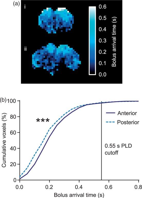 https://cdn.ncbi.nlm.nih.gov/pmc/blobs/be19/6681537/30bafcf037e2/10.1177_0271678X18756218-fig4.jpg
