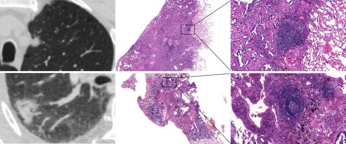 https://cdn.ncbi.nlm.nih.gov/pmc/blobs/be1d/9359870/c1418d1bf72b/CAM4-11-2969-g004.jpg
