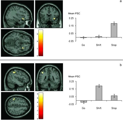 https://cdn.ncbi.nlm.nih.gov/pmc/blobs/be1e/3077432/924059137662/cercorbhq187f03_4c.jpg
