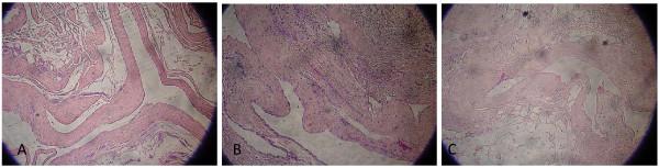 https://cdn.ncbi.nlm.nih.gov/pmc/blobs/be24/3170344/70e93c37df22/1752-1947-5-351-7.jpg