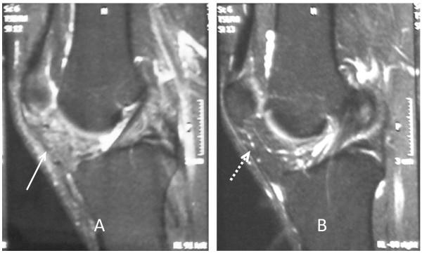 https://cdn.ncbi.nlm.nih.gov/pmc/blobs/be24/3170344/7ced502e9c85/1752-1947-5-351-8.jpg