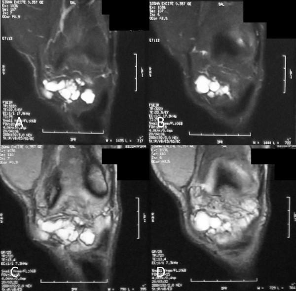 https://cdn.ncbi.nlm.nih.gov/pmc/blobs/be24/3170344/8e1ae47df1d5/1752-1947-5-351-3.jpg