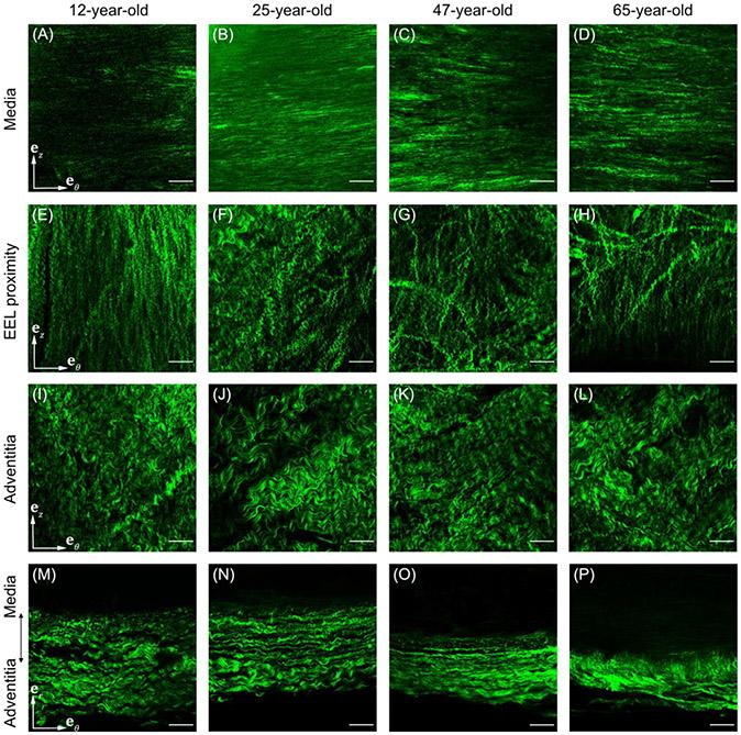 https://cdn.ncbi.nlm.nih.gov/pmc/blobs/be26/8464405/336210582bc5/nihms-1741260-f0008.jpg