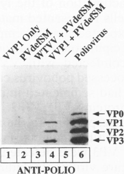 https://cdn.ncbi.nlm.nih.gov/pmc/blobs/be2c/237726/4df4cc403af8/jvirol00027-0739-a.jpg