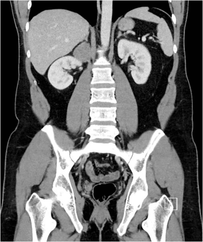 https://cdn.ncbi.nlm.nih.gov/pmc/blobs/be2d/6597528/1e72169a75ad/egi10GB88TQDLJ.jpg
