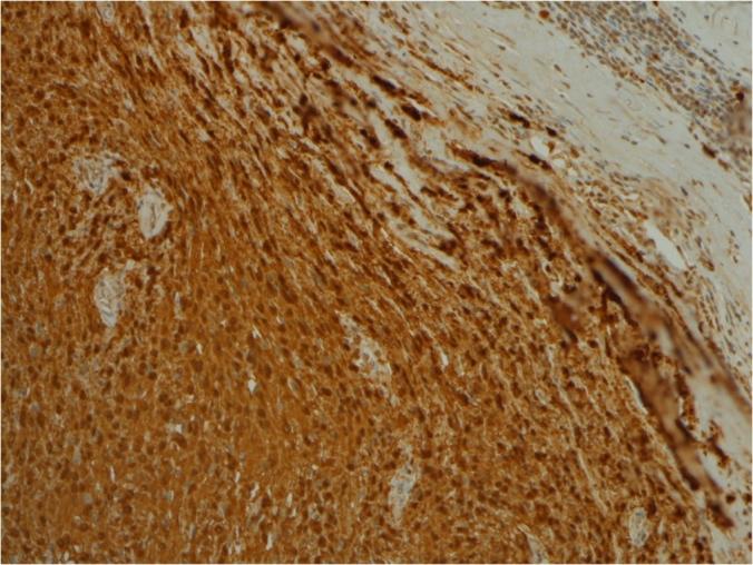 https://cdn.ncbi.nlm.nih.gov/pmc/blobs/be2d/6597528/334489f08514/egi10PDSS97JHW.jpg