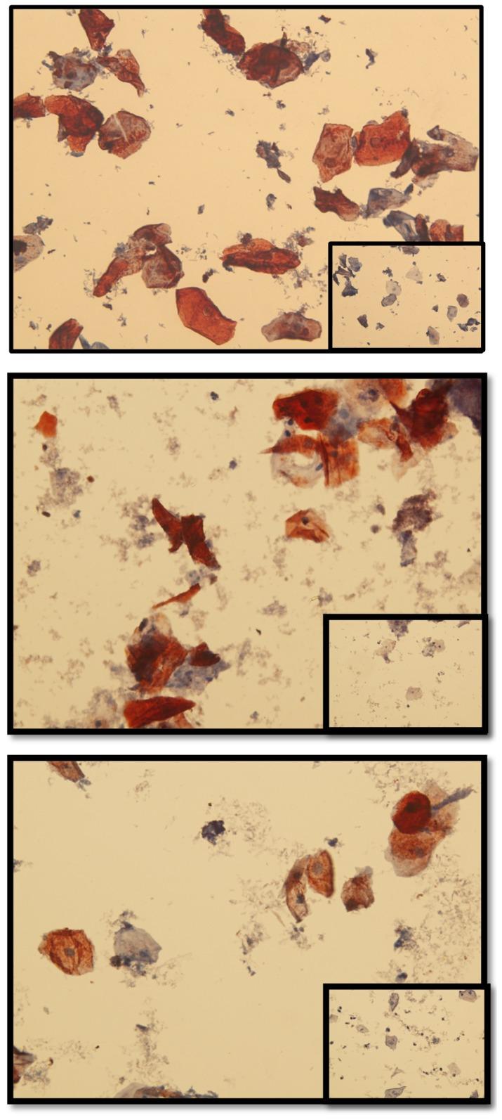 https://cdn.ncbi.nlm.nih.gov/pmc/blobs/be30/4260853/1bdbddf48727/pone.0114368.g008.jpg