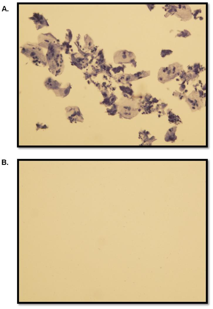 https://cdn.ncbi.nlm.nih.gov/pmc/blobs/be30/4260853/2cd9feaf726d/pone.0114368.g005.jpg