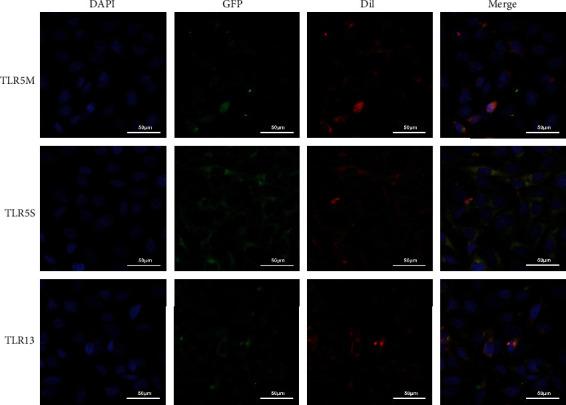 https://cdn.ncbi.nlm.nih.gov/pmc/blobs/be3a/7744196/c77ebe187bcf/IJG2020-4895037.006.jpg